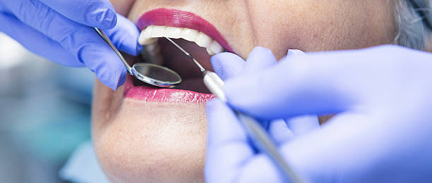 Best Emergency Root Canal Therapy in Hayden, CO